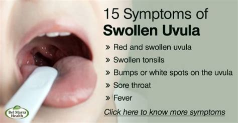 Swollen Uvula (Uvulitis): Causes, Symptoms, Treatment and Remedies | Swollen uvula, Swollen ...