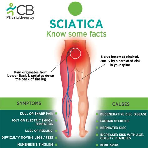 What causes sciatica to flare up top 10 triggers to avoid – Artofit