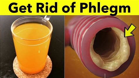 How To Get Rid Of Phlegm In Throat - Sheetfault34