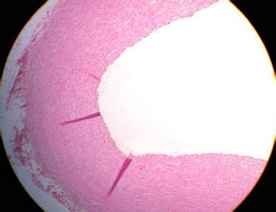 Vessels Histology - Aorta - histology slide