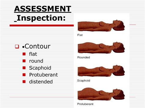 ASSESSMENT OF THE ABDOMEN - ppt download