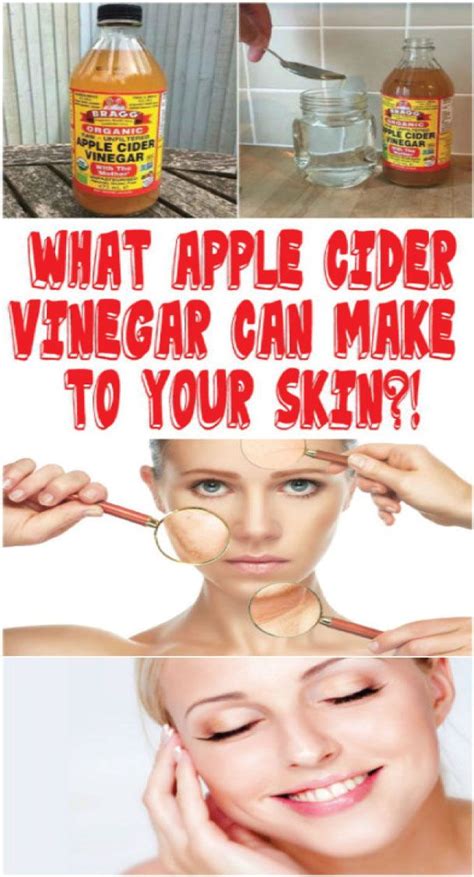 WHAT APPLE CIDER VINEGAR CAN MAKE TO YOUR SKIN | Apple cider vinegar ...