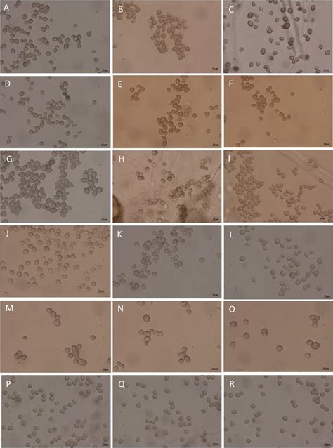 Rhizopus Oligosporus Microscope