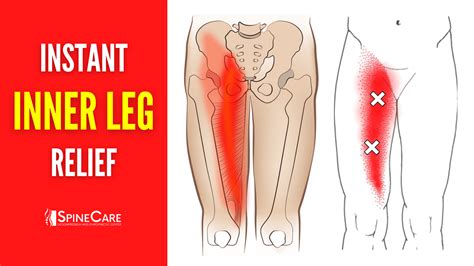 How to Fix Inner Leg Pain FOR GOOD | SpineCare