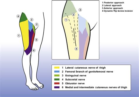 Fascia iliaca compartment block - BJA Education