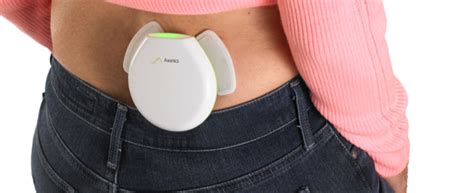 Axonics® System for Sacral Neuromodulation Overview