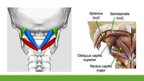 Suboccipital Triangle: Overview, Boundries & Contents » How To Relief