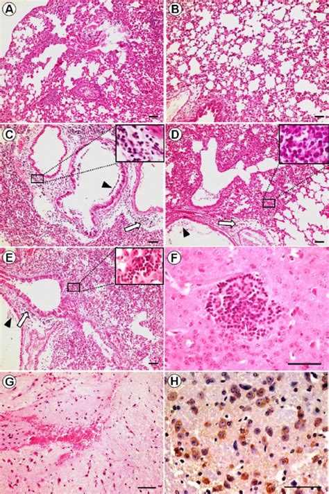 Photomicrographs of hematoxylin-and-eosin (H&E)-stained and... | Download Scientific Diagram