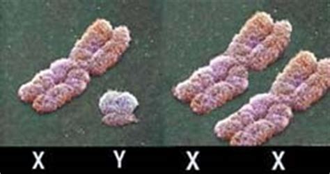 GenMedica - Biochemical laboratory -Cytogenetics centre -Tests - Cytogenetics - Karyotype