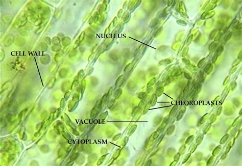 Plant Cell Under Microscope 400x