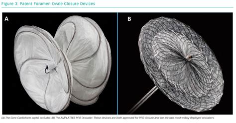 Patent Foramen Ovale Closure Devices | Radcliffe Cardiology