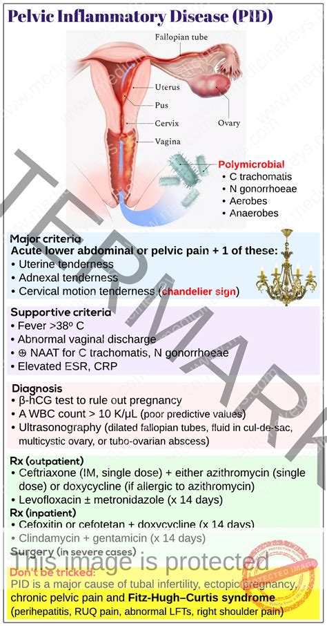 Pelvic inflammatory disease (PID) - Medicine Keys for MRCPs