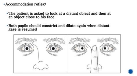 How To Test For Concussion Pupils