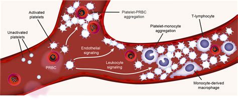 Neutrophil Extracellular Traps Nets