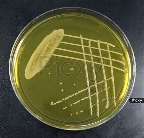 Image of Mannitol Salt Agar-PK886573-Picxy