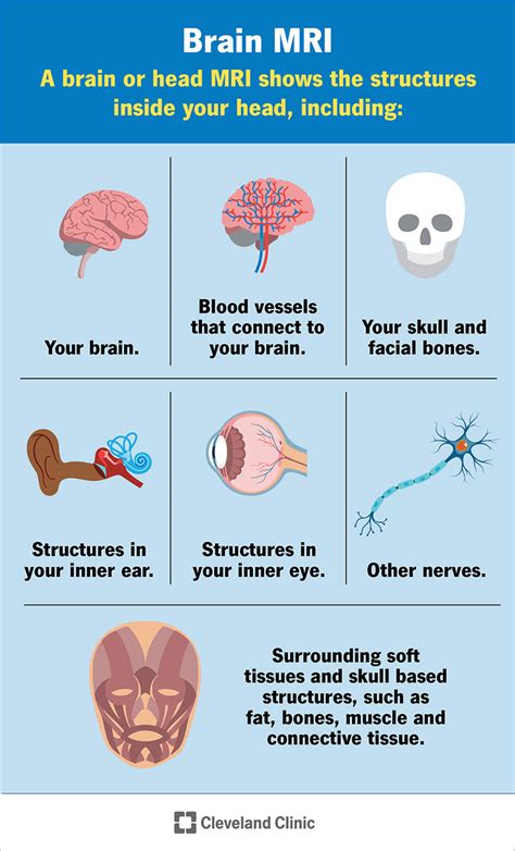 Smegenų MRT: Kas Tai Yra, Tikslas, Procedūra Ir Rezultatai - SFOMC