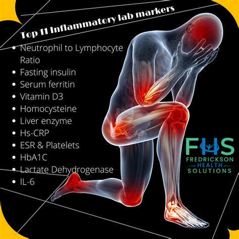 TOP 11 Inflammatory Markers for Chronic Pain, and optimal ranges.