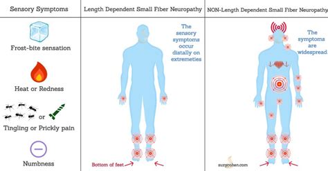 Small Fiber Neuropathy Causes and Treatment - Suzy Cohen suggests ways to heal naturally without ...