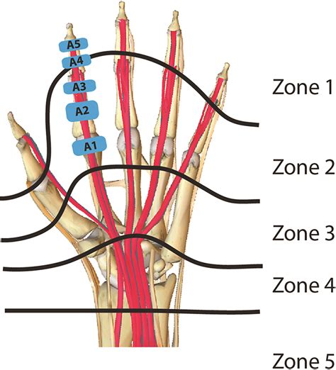 037 | Hand Part 05 | The Flexor Tendons – Emergency Medicine Ireland | Antrim ED Meducation