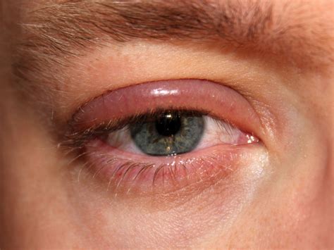 Eye disorders: understanding the causes, symptoms and management - The ...