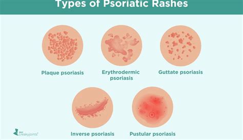 What Does It Mean If A Rash Is Warm To The Touch - Printable Templates Protal