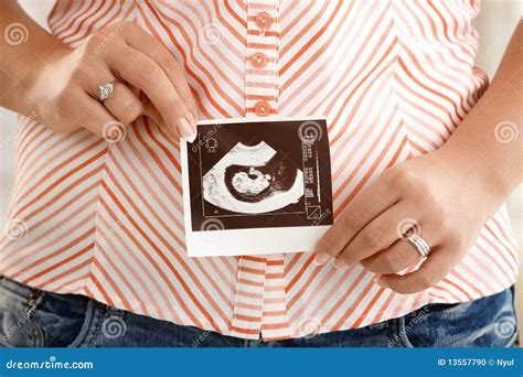 Pregnant Tummy with Ultrasound Picture Stock Photo - Image of focus, hand: 13557790