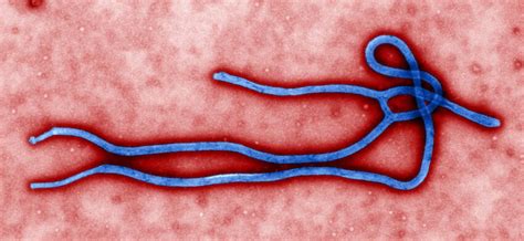 Imagem gratuita: ultra-estruturais, morfologia, ebola, vírus vírion