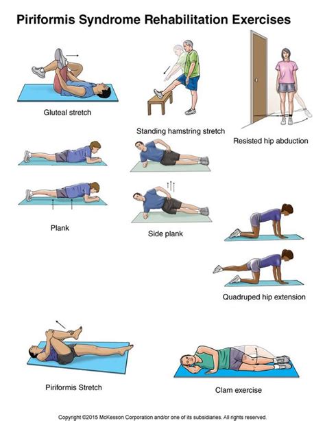 Piriformis Syndrome Exercises: Illustration | Piriformis syndrome ...