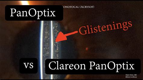 PANOPTIX vs CLAREON PANOPTIX. Difference in Glistenings? - YouTube