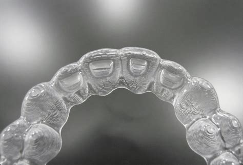 3 Ways Bite Ramps Help Invisalign Efficiency - The Dawson Academy