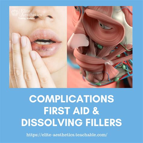 Complications, First Aid and Dissolving Dermal Fillers | Elite