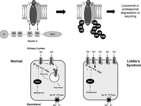 Molecular pathomechanism of Liddle's syndrome. Upper panel: The... | Download Scientific Diagram