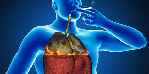 Smokers Or Past Smokers: Six Ways To Cleanse And Revitalize Your Lungs – Healing the Body