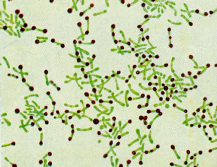 USMLE Pathology Slides - Stained Corynebacterium cells. The “barred”...