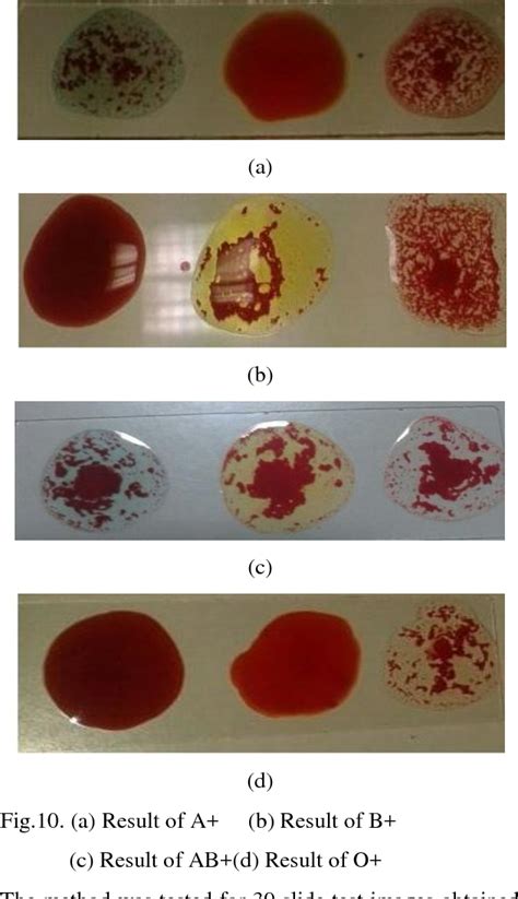 Determination and Classification of Blood Types using Image Processing Techniques | Semantic Scholar