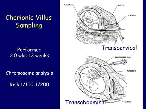 PPT - Prenatal Testing And Screening PowerPoint Presentation, free download - ID:9709391