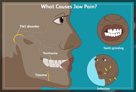 Ways to Cope with Misaligned Jaw Pain - Dentist Ahmed