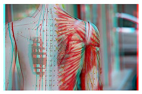 The Benefits of Acupuncture for Lower Back Pain Management — Yin Studio