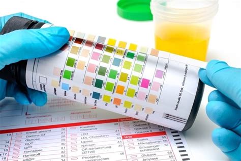 Leukocytes in Urine: Top 6 Causes, Tests & Normal Levels - Tua Saúde