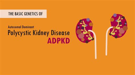 The Basic Genetics of Autosomal Dominant Polycystic Kidney Disease - YouTube