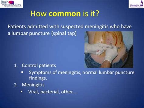 Viral Meningitis: A real pain in the neck by Dr Fiona McGill