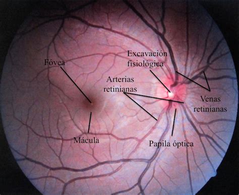 Relacion Arteria Vena En Fondo De Ojo - Consejos Ojos