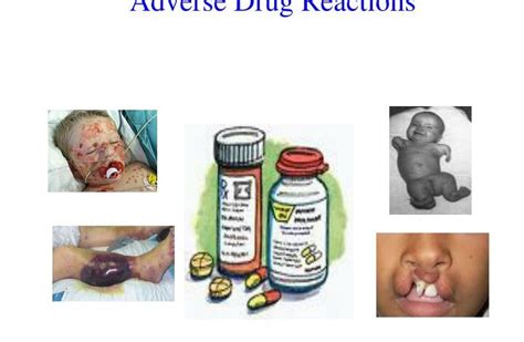 The 5 Types Of Adverse Drug Reactions (ADRs)? - Meds Safety