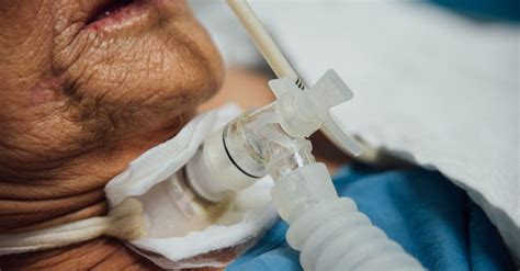 Tracheostomy: Purpose, Preparation, Procedure, Results & Risks