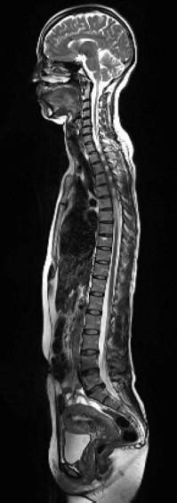 ZeroRad Scan™ - Whole Body MRI (wb MRI) - Santa Monica, CA: Smart Heart and Health Preventive ...