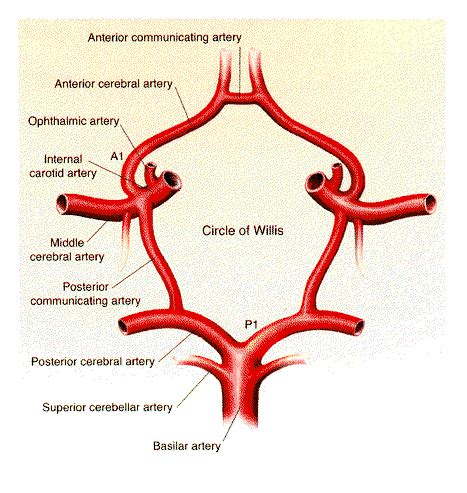 Infarction: Cerebral Artery Occlusion With Cerebral Infarction