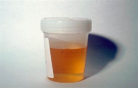 The Color Of Your Urine Reveals About Your Health Issues. Must Know!!