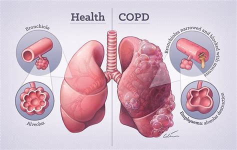 Portfolio - Medical Illustration by Dr Ciléin Kearns (Artibiotics) — a ...