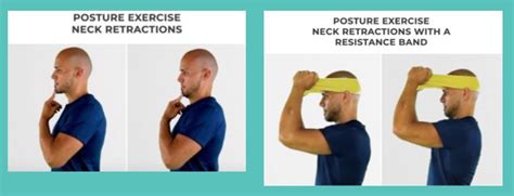 A Quick Fix For Slumped Posture — Francesca Carleo Physiotherapist