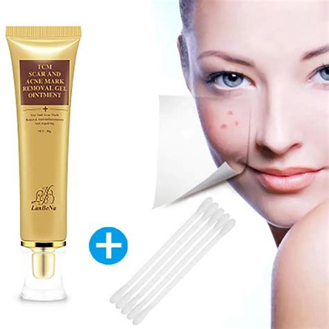 Aliexpress.com : Buy Acne Scar Stretch Marks Remover Cream Skin Repair ...